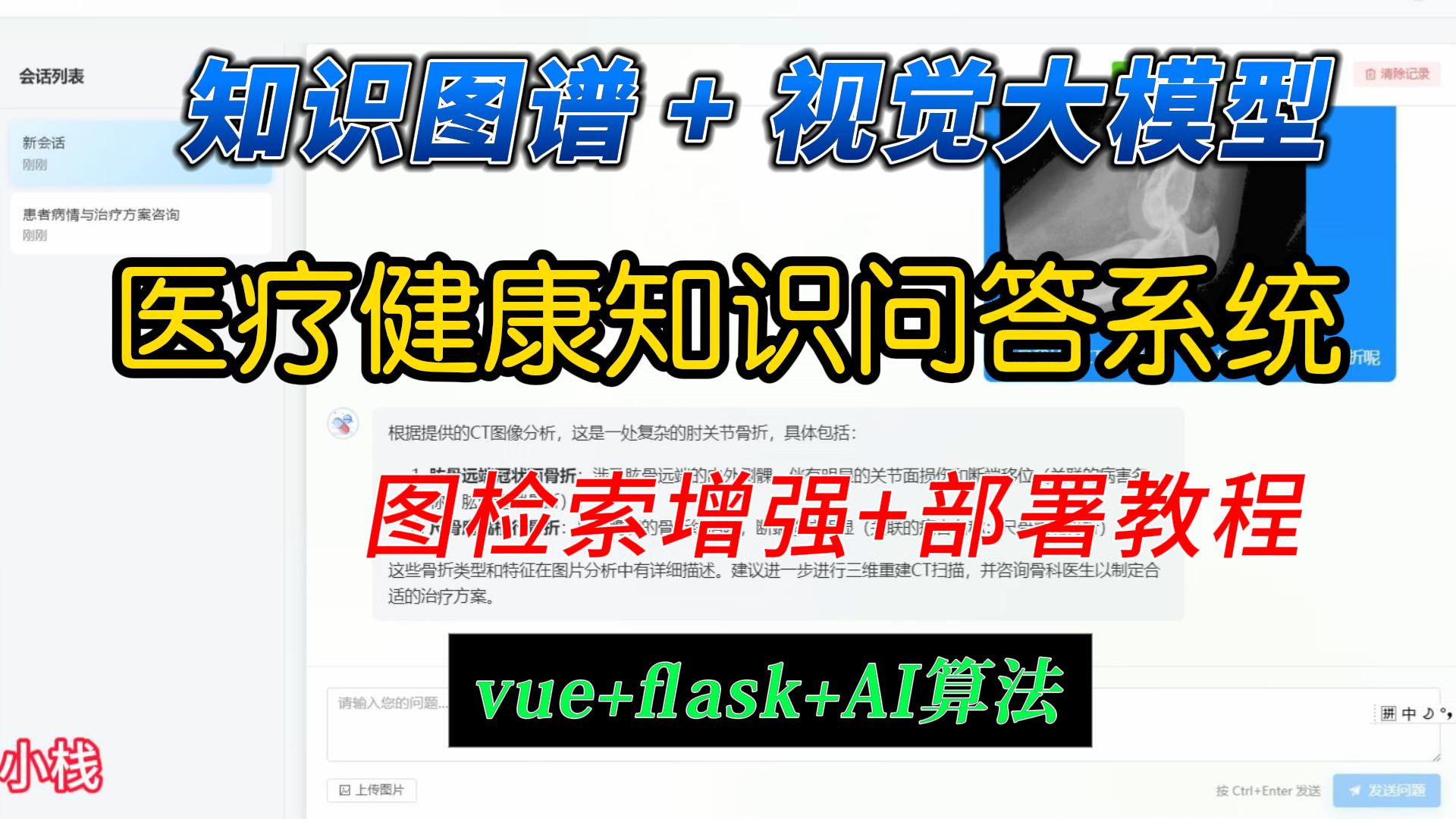 知识图谱的医疗问诊系统