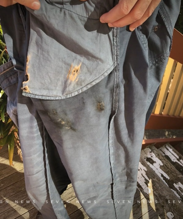 iPhone-X-Exploded-in-Melbourne-Man-Pocket-2.jpg