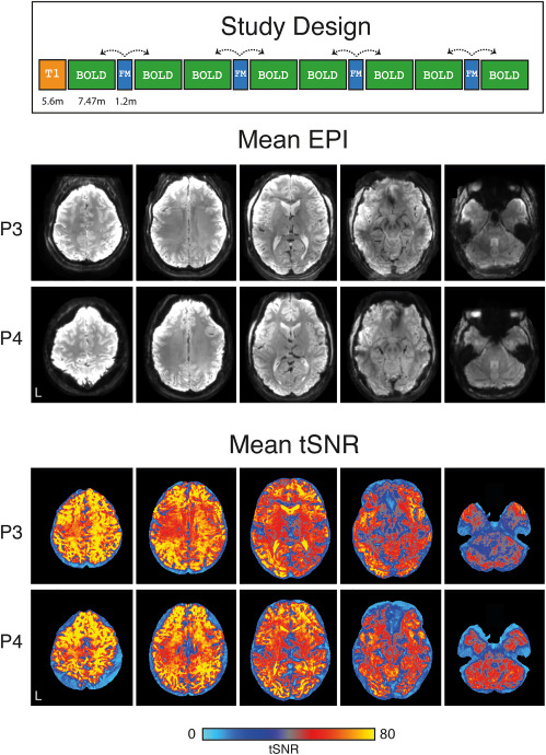 1-s2.0-S0896627323004026-gr1.jpg