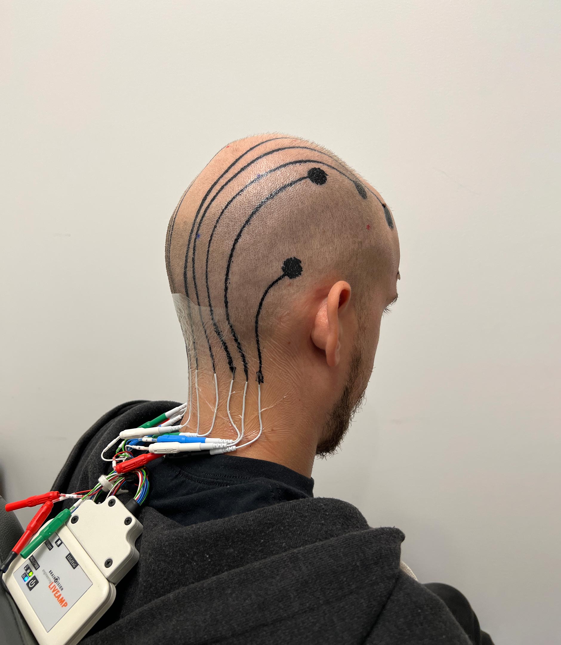 EEG-Setup-E-Tattoo-Electrodes.jpg